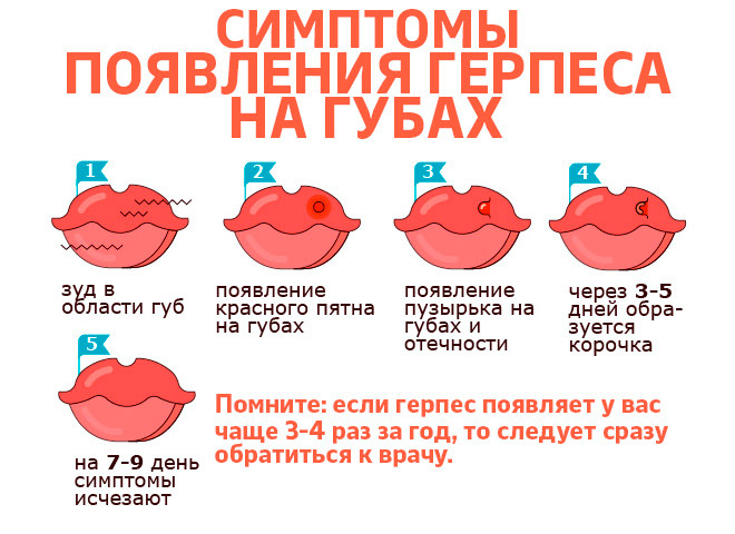 Герпес