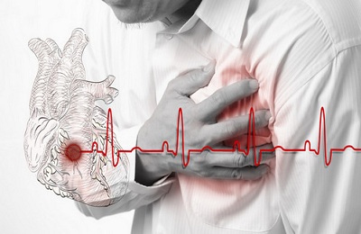 Учащенное сердцебиение