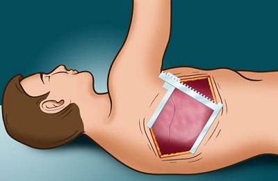 Проведение операции