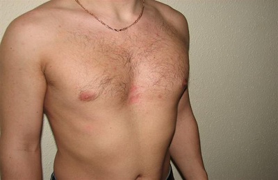 Грудная клетка