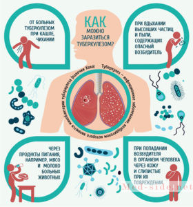 Что такое туберкулез в 21 веке, органы мишени и расшифровка диагноза с МБТ и МЛУ