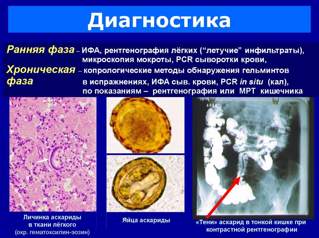Методы обнаружения глистов