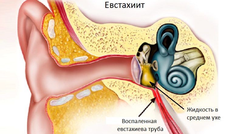 Евстахиит