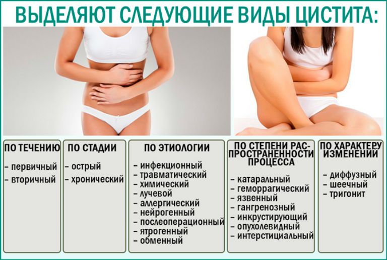 осложнения цистита у женщин