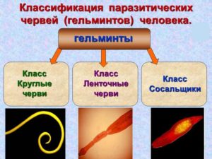 Глисты