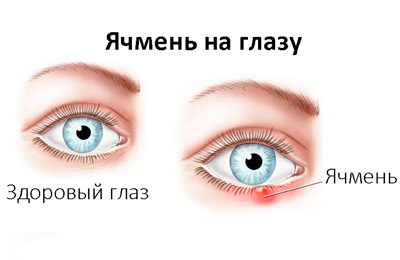 Ячмень