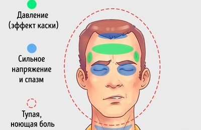 Головная боль
