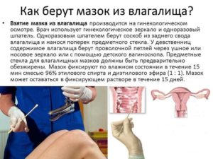 Как берут мазок из влагалища