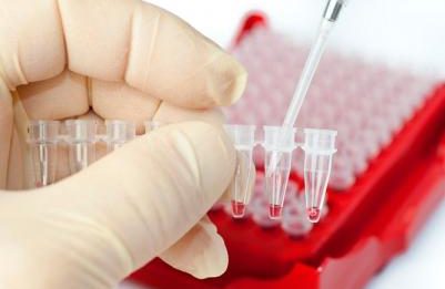 биохимия крови